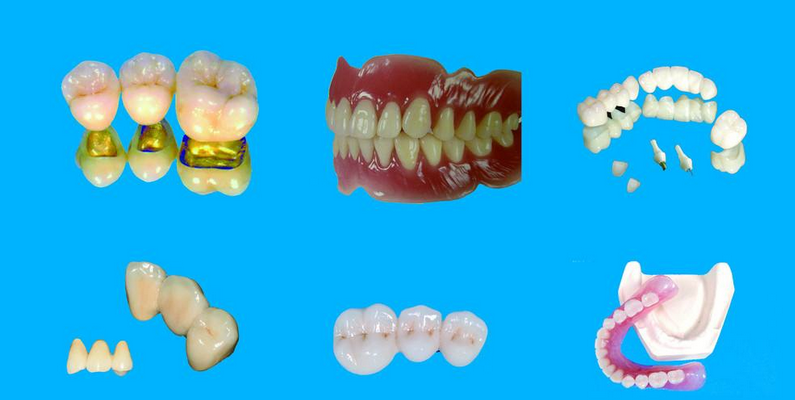 假牙有哪些材料的类型_深圳爱康健口腔医院